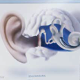 Аудиологические и медицинские показания к применению слуховых аппаратов костной проводимости Ponto