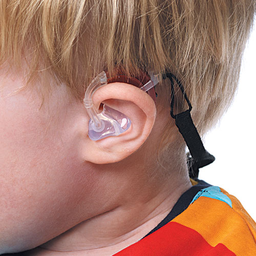 Особенности слухопротезирования детей разных возрастов