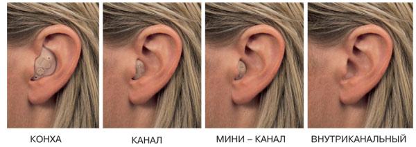 внутриушные слуховые аппараты