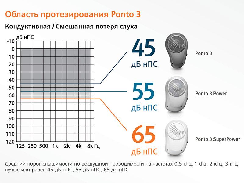 Область протезирования Ponto 3 Кондуктивная/Смешанная потеря слуха